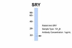 SRY Rabbit anti-Human, Polyclonal, Novus Biologicals 0.1 mL | Buy Online | Novus Biologicals | Fisher Scientific